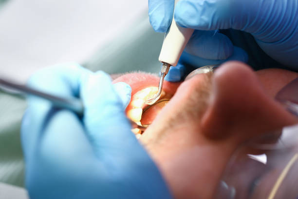 Best Emergency Care for Gum Disease in West Hills, NY
